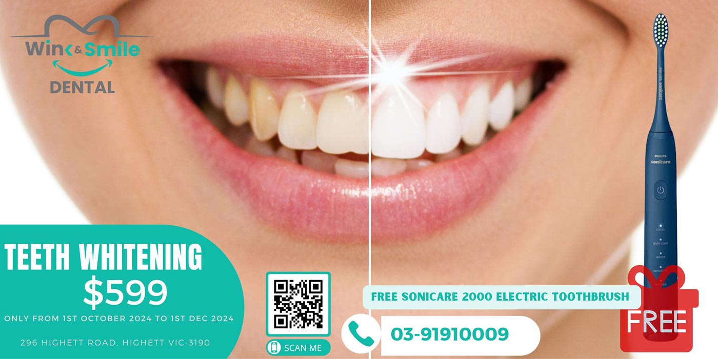 Teeth Whitening Offer Highett